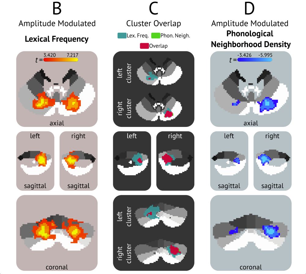 Schematic showing the activation patterns in the cerebellum as the correlate with changes in lexical frequency and phonological neighborhood density.