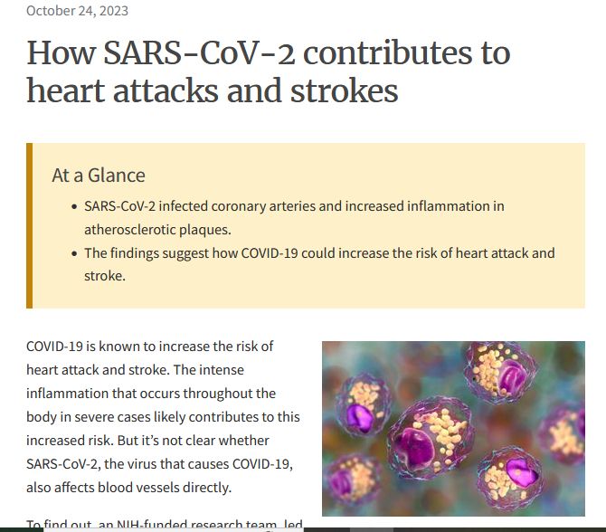 screenshot of text and study title October 24, 2023 How SARS-CoV-2 contributes to heart attacks and strokes At a Glance SARS-CoV-2 infected coronary arteries and increased inflammation in atherosclerotic plaques. The findings suggest how COVID-19 could increase the risk of heart attack and stroke. Image Foam cells. Foam cells, which accumulate within arteries to form plaques in atherosclerosis, proved particularly susceptible to infection with SARS-CoV-2. Kateryna Kon / Shutterstock COVID-19 is known to increase the risk of heart attack and stroke. The intense inflammation that occurs throughout the body in severe cases likely contributes to this increased risk. But it’s not clear whether SARS-CoV-2, the virus that causes COVID-19, also affects blood vessels directly. To find out, an NIH-funded research team, led by Dr. Chiara Giannarelli at New York University School of Medicine, analyzed coronary artery tissue samples from eight people who died of COVID-19 between May 2020 and May 2021. Results appeared in Nature Cardiovascular Research on September 28, 2023. more on link https://www.nih.gov/news-events/nih-research-matters/how-sars-cov-2-contributes-heart-attacks-strokes 