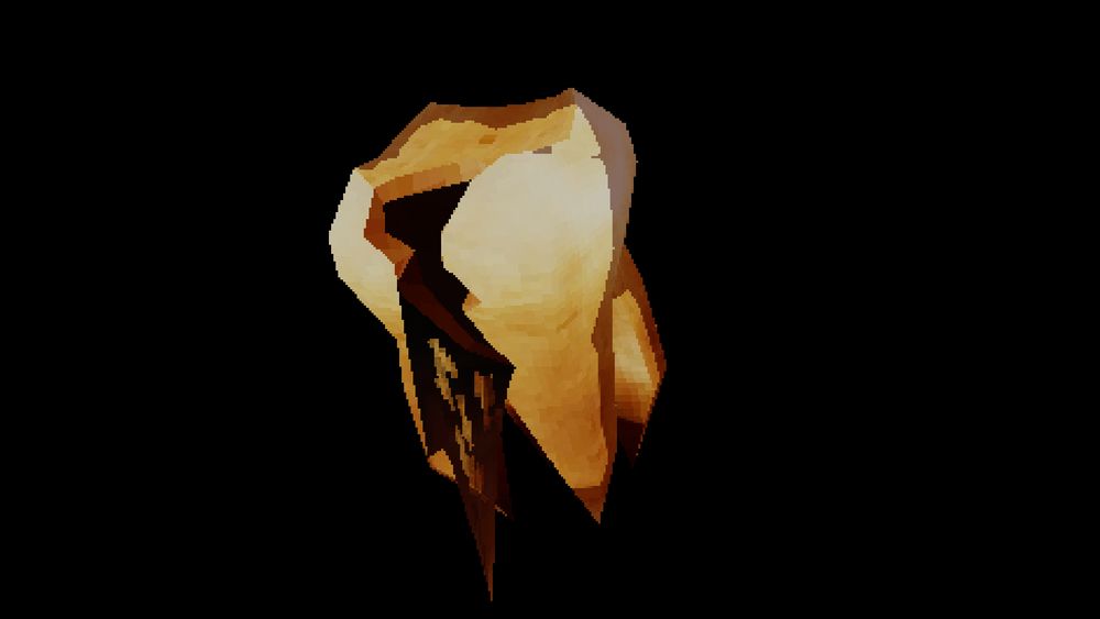 Decaying tooth dripping black sludge