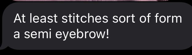 Text from my mom that says, “At least stitches sort of form a semi eyebrow!”