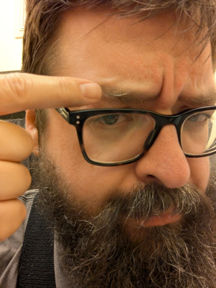 A bearded man pointing to a grey hair in his eyebrow.