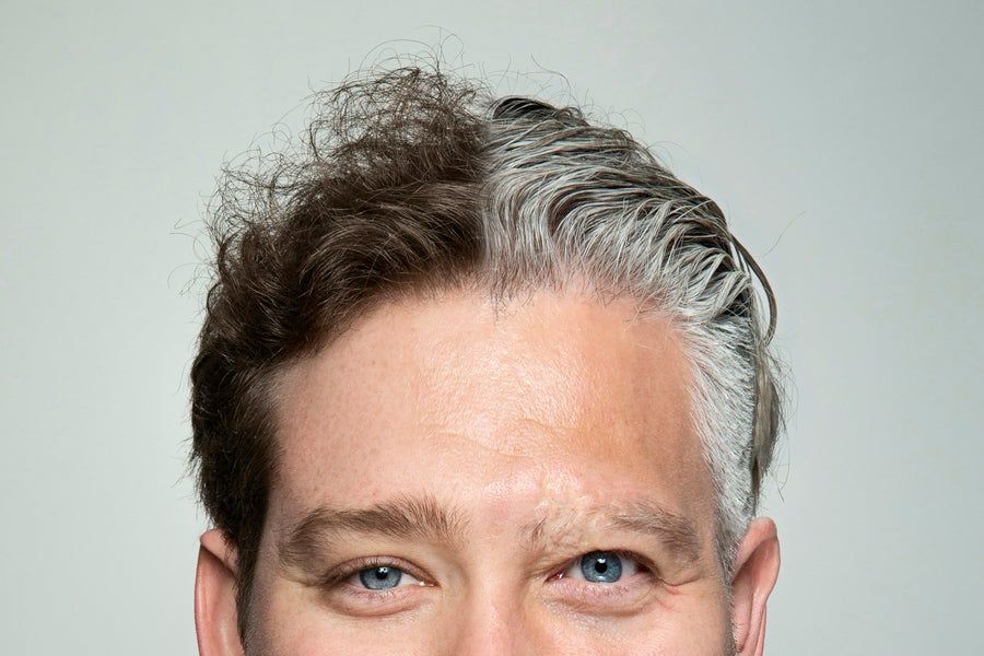 Photo of man from the nose up. Half his hair is brown and half is grey. 