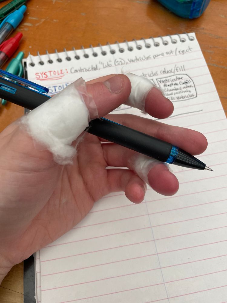 a pale left hand holding a black mechanical pencil over a lined notebook. white fluff has been scotch-taped onto the thumb, index finger, and ring finger as a makeshift padded bandage.