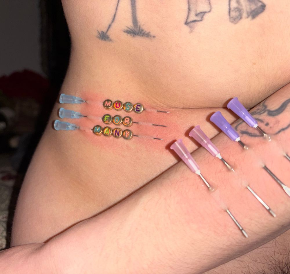 an arm pierced with four needles, two with pink hubs and two with lilac hubs, crosses in front of a stomach pierced with three more needles. the needles in the stomach are much longer and have beads threaded on their shaft. the beads are metallic, shiny, and read “muse for many”.