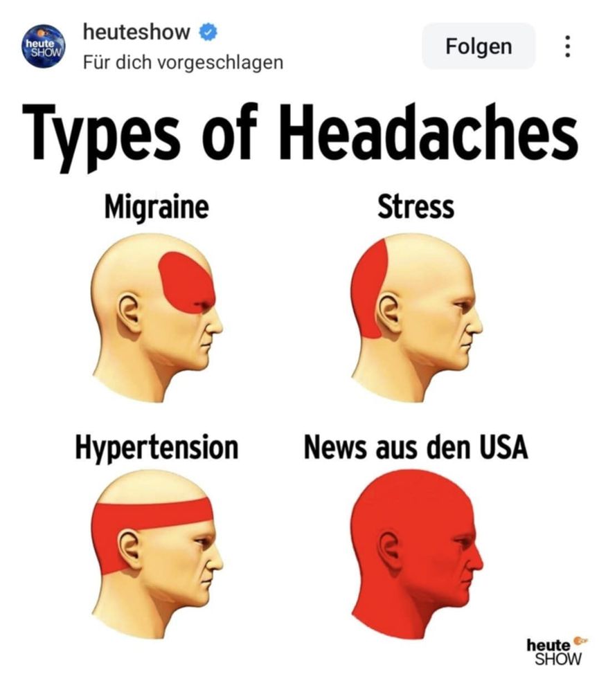 Four images of a human head showing Types of Headaches: first one with pain behind eyes is labeled "Migraine"; second with pain at back of head labeled "Stress"; third one with pain around the crown of the head labeled "Hypertension"; fourth one with pain indicated over the entire head labeled "News ads den USA (News from the US)".