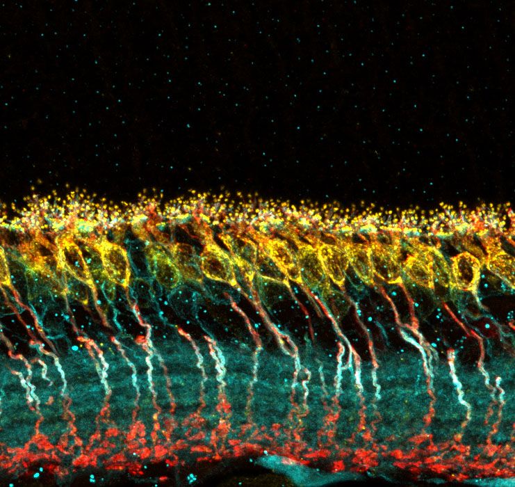 Confocal microscope image of mouse retina labeled with antibodies for PKCalpha (red), TRPM1 (yellow), and 4.1B (cyan).