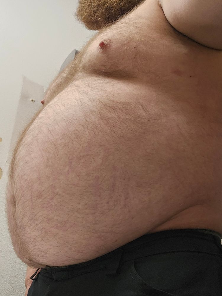 Large man with bmi of 44.5