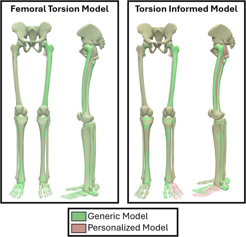 Alignment of the femur and tibia before and after personalization. This figure presents how the Torsion Tool changes the shape and alignment of the femur and tibia (red) compared to the generic torsion model (green). The left side represents the personalization for the femoral torsion model, while the right side represents the personalization for the torsion-informed model. The personalized models represent one participant with a 36° femoral version and 38° tibial torsion.