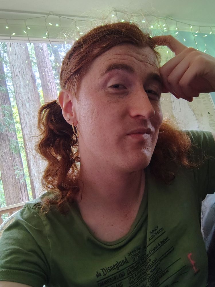 A redhead with shaved sides and freckles