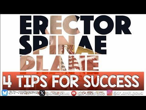 Tips for successful ESP Block - An Update