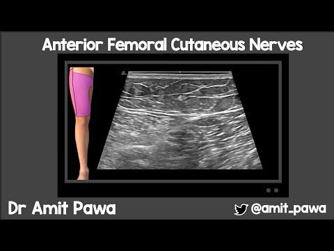 Anterior Femoral Cutaneous Nerve Block