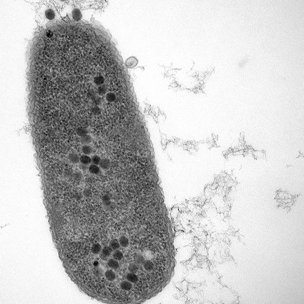 Bacteria infected with phage. Dots show phage replication sites.