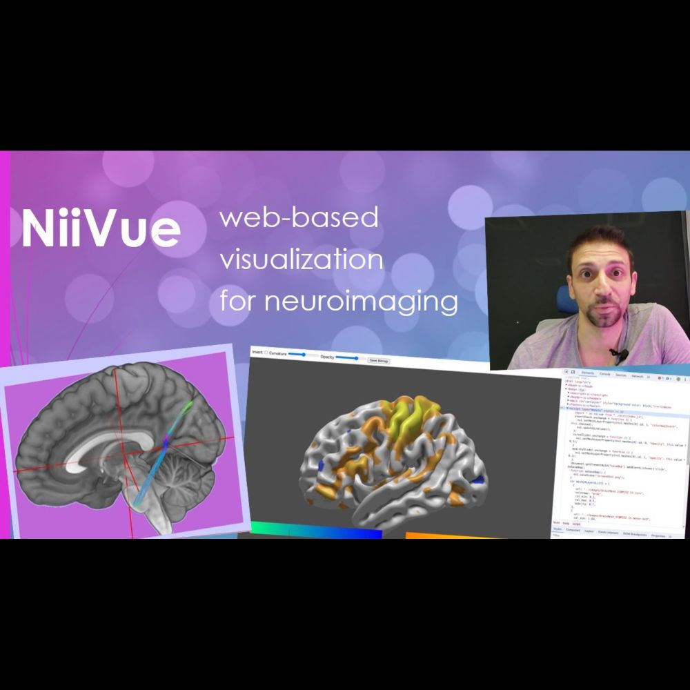 NiiVue is web-based visualization tool for neuroimaging using html and javascript/webgl loading Nii