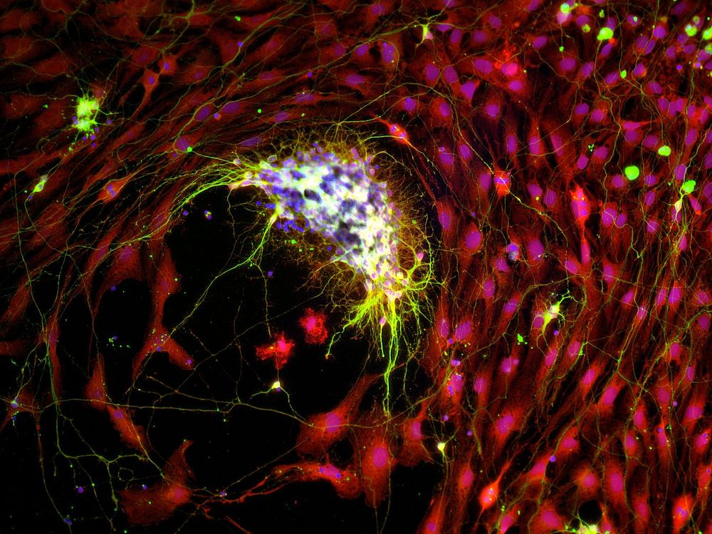 Myoblasts labelled with phalloidin, embryonic rodent ventral spinal cord neurons with beta(III) tubulin, nuclei with DAPI.
