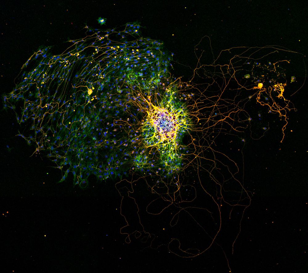 Hoecsht (blue), phalloidin (green), and beta (II) tubulin (red) on 2-day old murine dorsal root ganglia, which seems to have had some meninges or something attached (hence the fibroblast-y cells on the left)