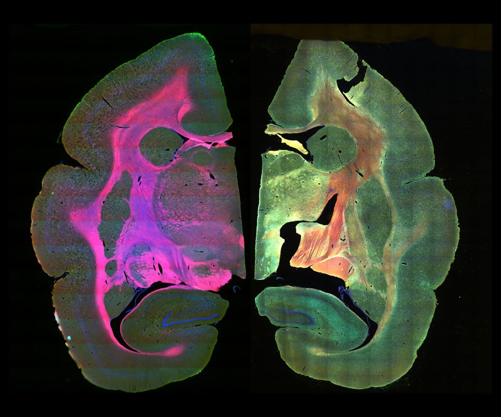 Marmoset coronal sections. Left labelling is Hoechst (blue), Ferritin (green), and Fluoromyelin Red (red); right is MAP2 (blue), Tuj1 (green), and MBP (red). Montages stitched from ~200 tiles, thx imageJ.