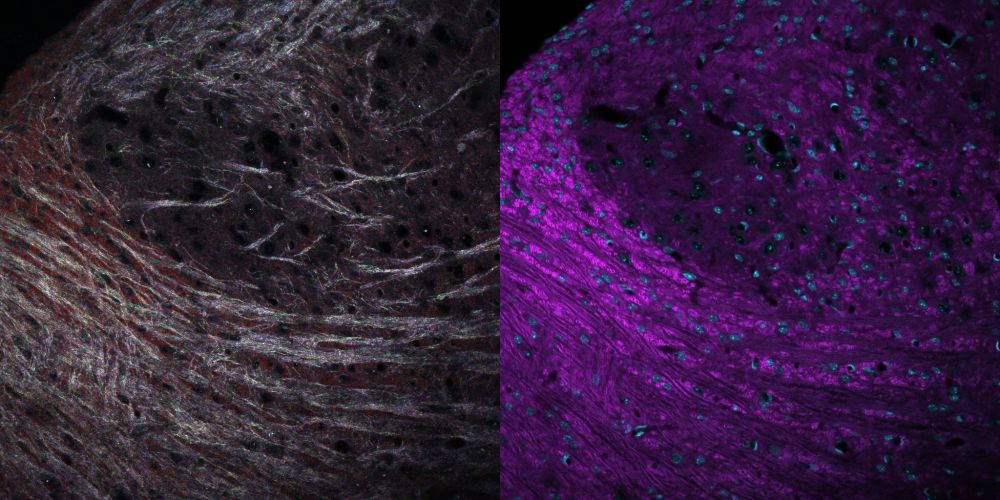 This cool technique is called SCoRE (spectral confocal reflectance microscopy) first published by Schain et al in 2015 (https://doi.org/10.1038/nm.3495)