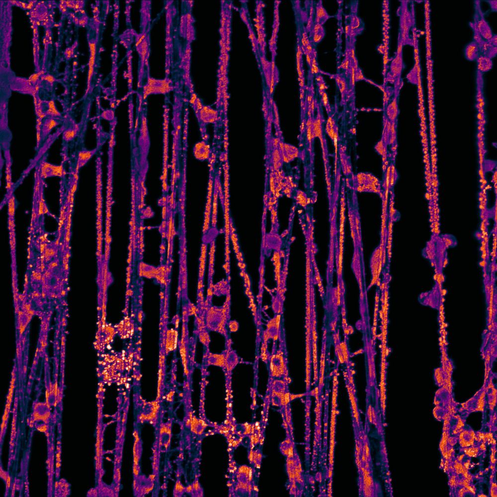 Live oligodendrocytes cultured on poly-L-lactic acid electrospun fibers, stained with the fluorescent lipid dye Fluoroymelin Red (which weakly labels the fibers, and strongly labels the cell membranes).