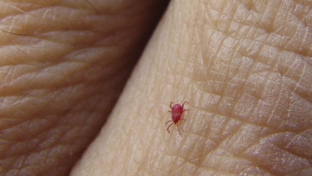 It’s Chigger Season. Here’s What to Know About the Pests.