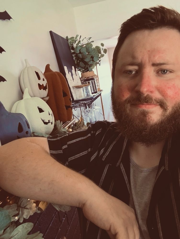 A chubby bearded man with a lazy eye and splotchy red cheeks leans on a fireplace mantle. You can see various pumpkins and that the mantle is decorated for Halloween.