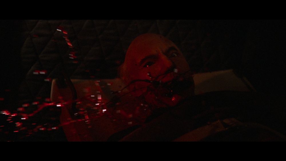 Patrick Stewart being exsanguinated.