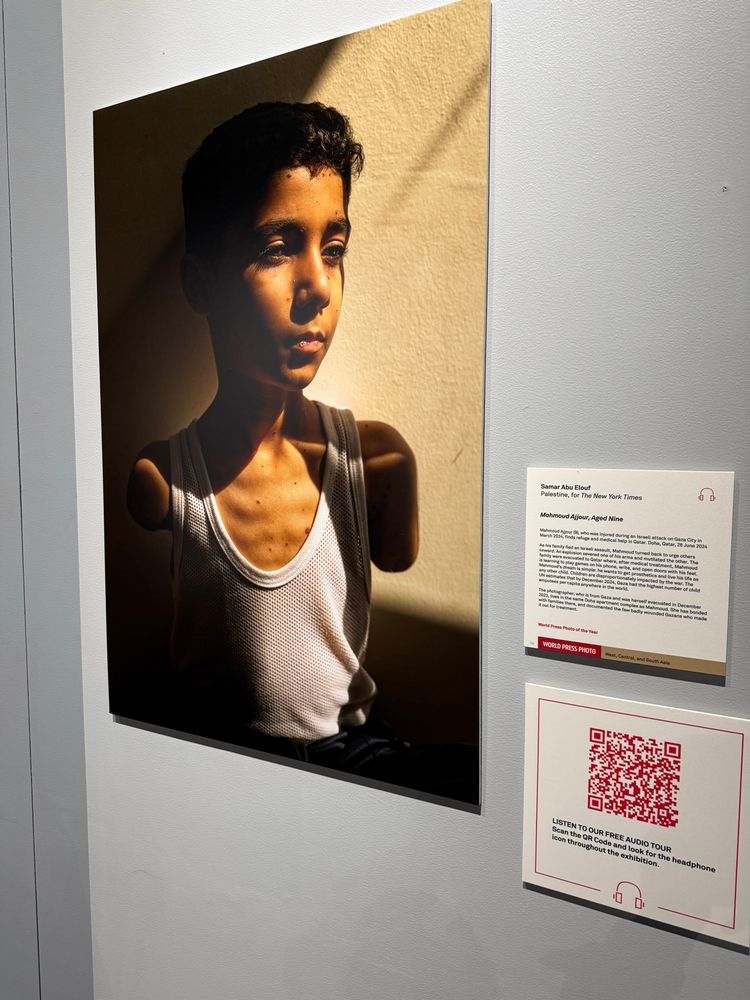 Image of Picture of the Year for 2025 shows a boy aged 10 in a white singlet. Both arms are amputated and he is looking away from the camera with shadows of light highlighting his face.