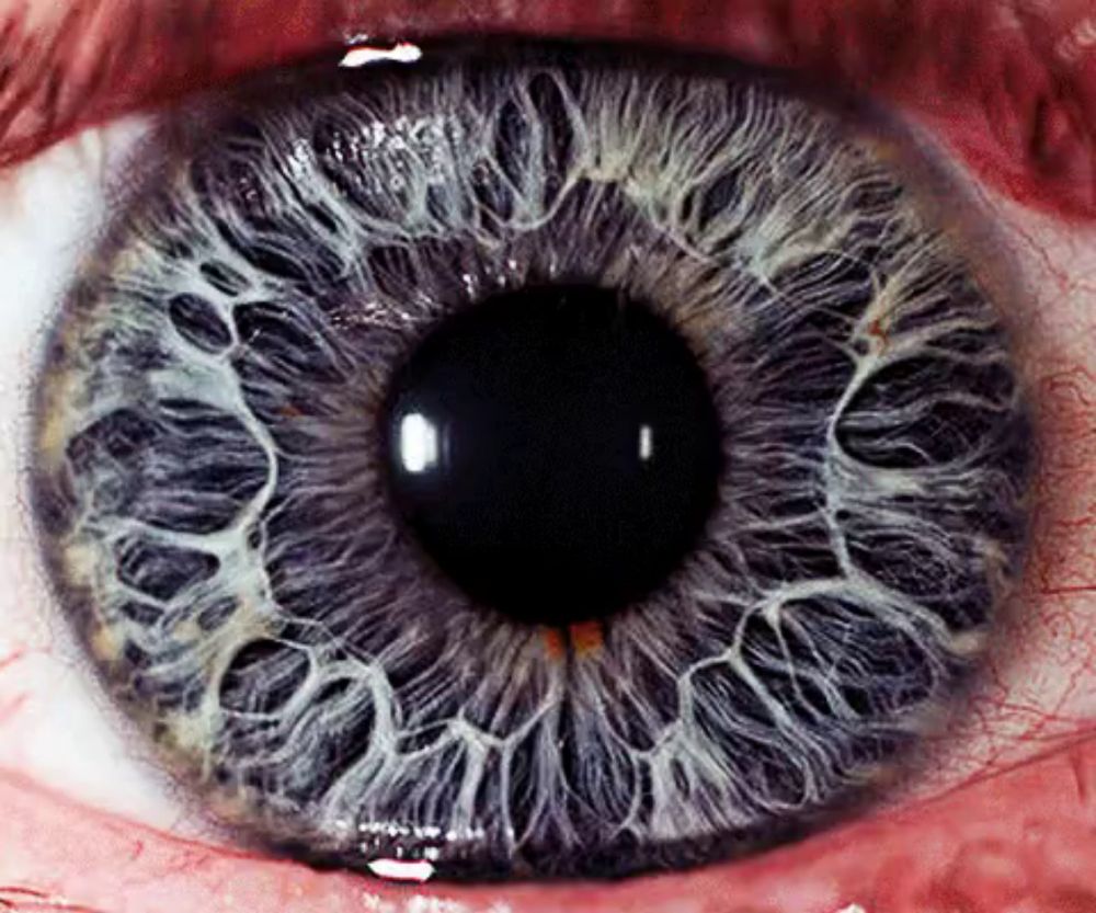 a close up of a person 's blue eye with a black pupil