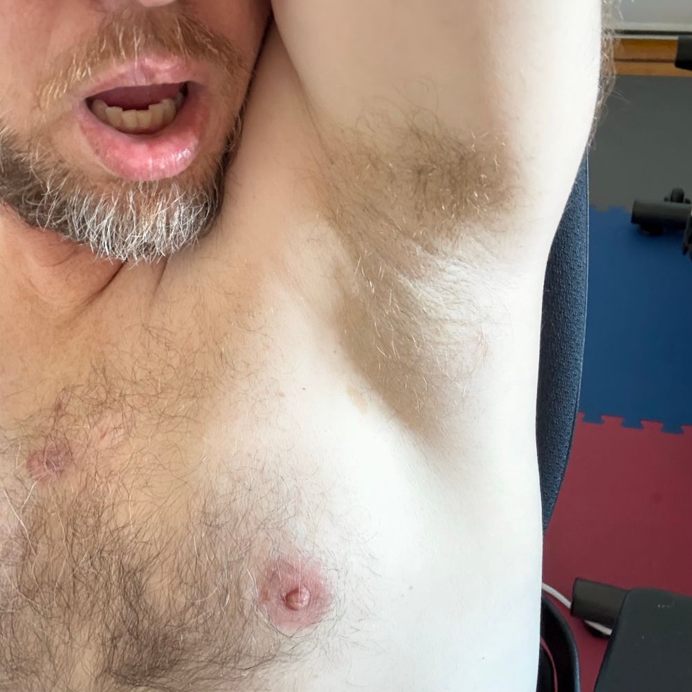 A man’s armpit and open mouth