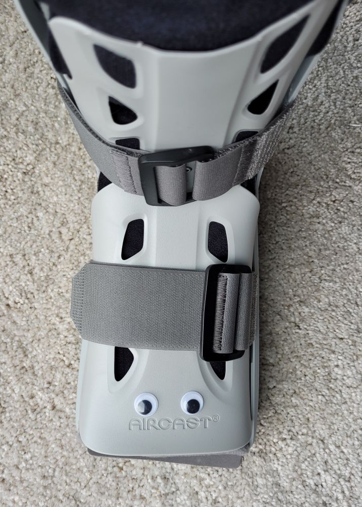 Photo of an Aircast walking boot with googly eyes on it, thus making it 1000% better