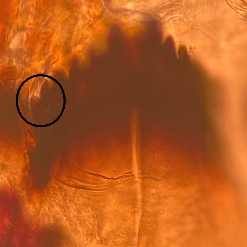 A picture of the mentum of Brillia longifurca (Diptera, Chironomidae) highlighting the outer teeth, long and well separated