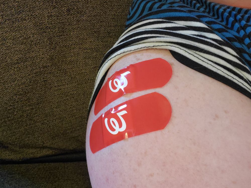 A shoulder with two red walgreens bandaids on it from vaccines