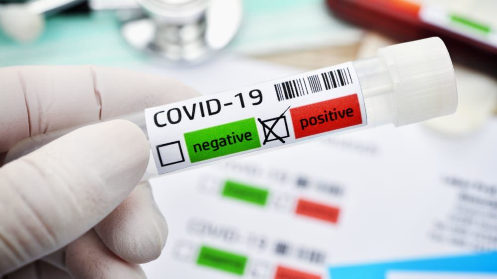 Methode: SARS-CoV-2 PCR | Wert: positiv