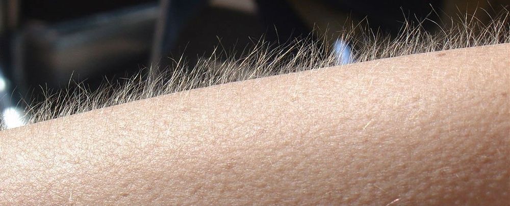 Braço com pelos arrepiados.