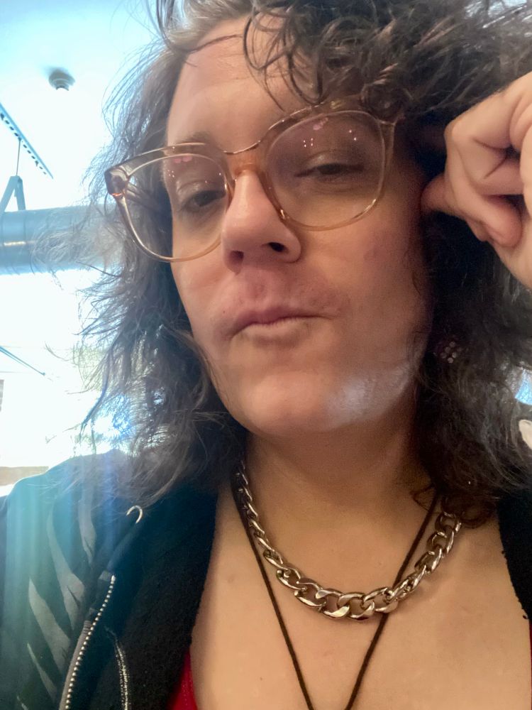 Middle-aged transfem Molly sans makeup doing the duck face and showing off her red recently lasered upper lip.