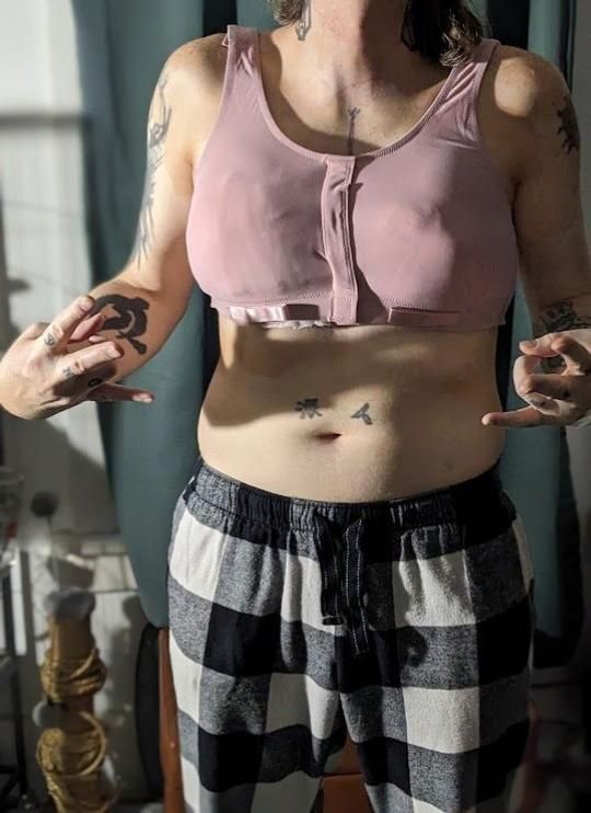 Front photo of a trans woman's torso post breast augmentation-slash-enhancement. She is wearing a pink bra and is trying to look "cool" with hand gestures, but is mostly tired due to the procedure. Her face is hidden as she is still shy to show herself online