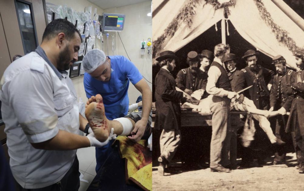 Israel Has Bombed Gaza's Healthcare System Back to the 19th Century