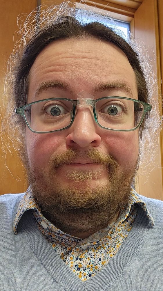 Me wearing glasses crudely taped together at the bridge. They're slightly askew, but on my face at least.