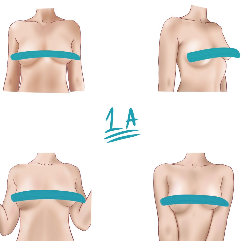 A closeup of 4 female torsos, with blue censor bars covering up the breasts