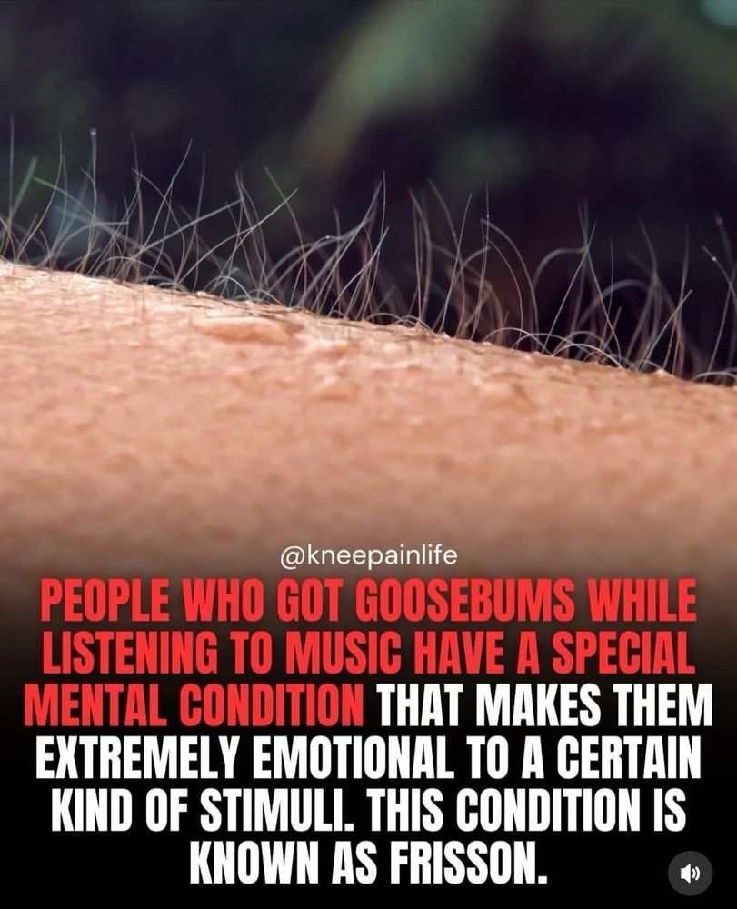 “People who got goosebumps while listening to music have a special mental condition that makes them extremely emotional to a certain kind of stimuli. This condition is known as as frisson.”