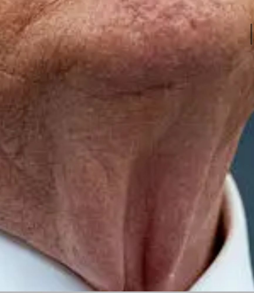 Comment image