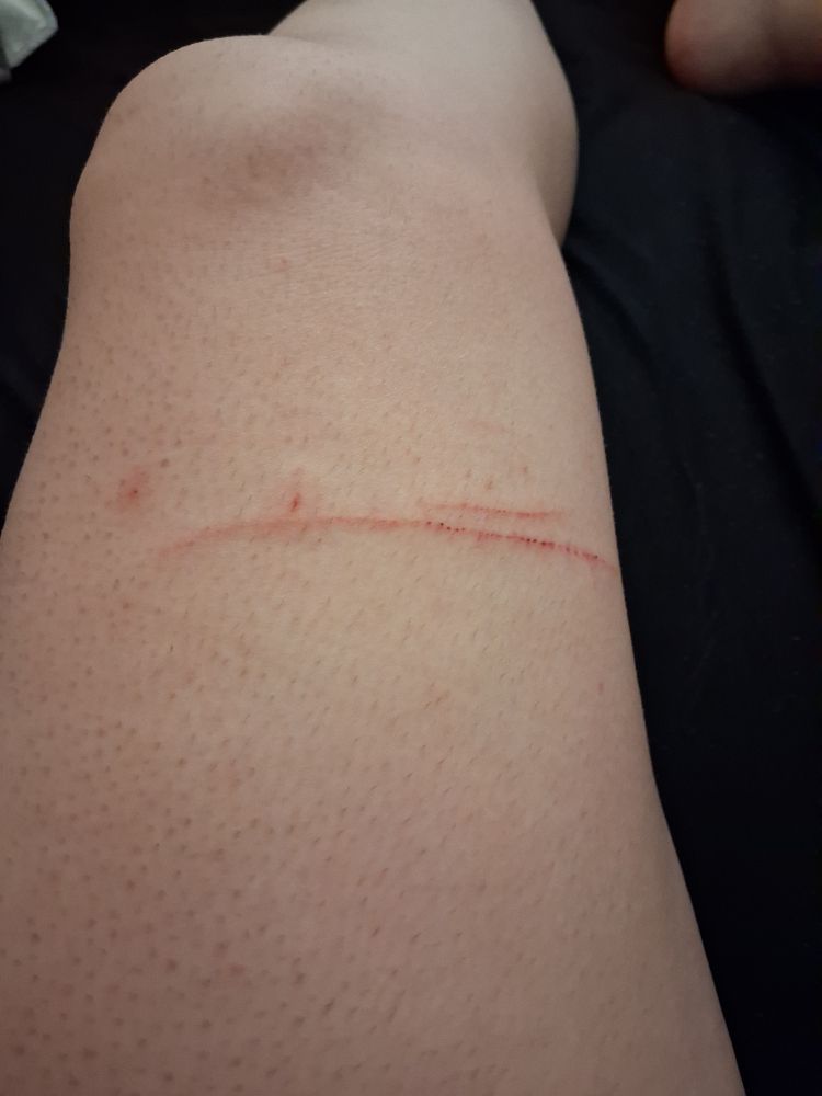 Two nice long scratches because my youngest cat is an idiot.
