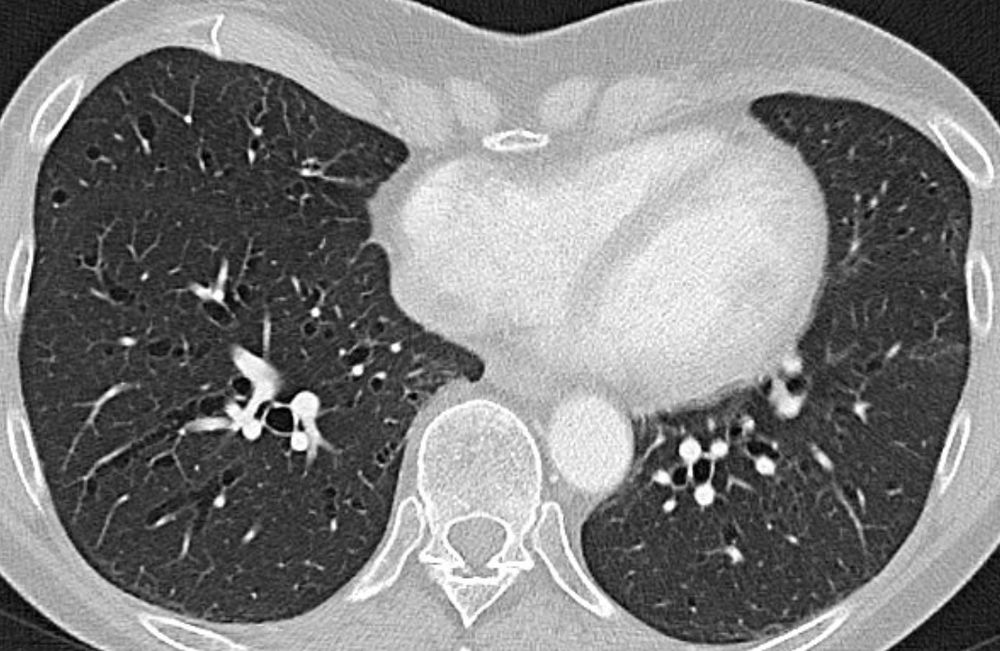 Ein CT-Bild, leider kann ich es nicht genauer beschreiben, da dann ja die Challenge aufgelöst wäre. Bei Interesse gerne DM