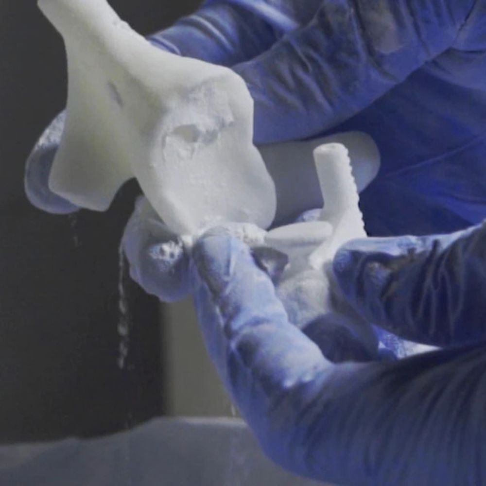 A person wearing blue surgical gloves holds a 3D-printed model of a bone, showing details and texture, against a dark background.