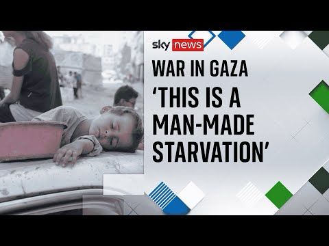 Inside Gaza's Nasser Hospital - where there's virtually no food for malnourished children