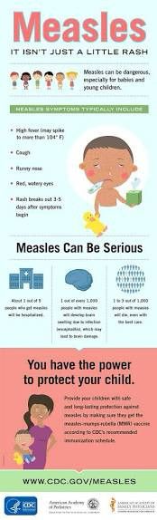 Measles
IT ISN'T JUST A LITTLE RASH

Measles can te dargerous. ispecisty dor tubies and young chidien

Measles Can Be Serious
