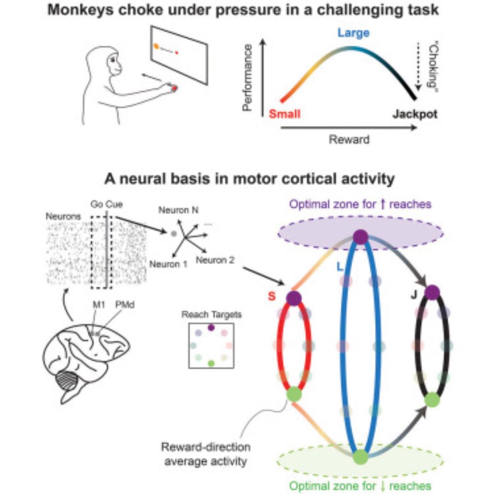 A neural basis of choking under pressure