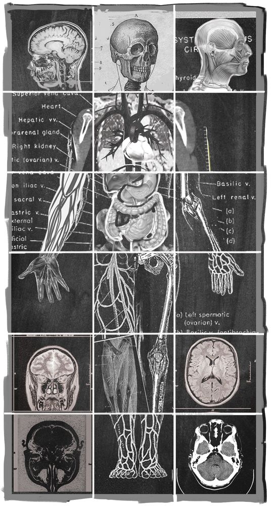 A 3 by 6 grid of different anatomical renderings, scans, and overlaid art. 