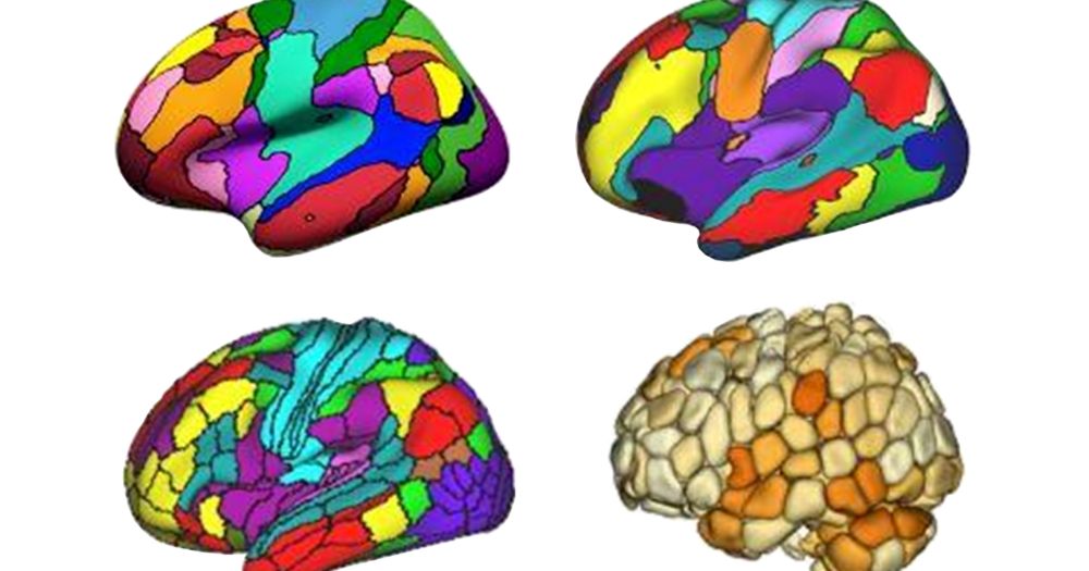 New ‘decoder’ tool translates functional neuroimaging terms across labs