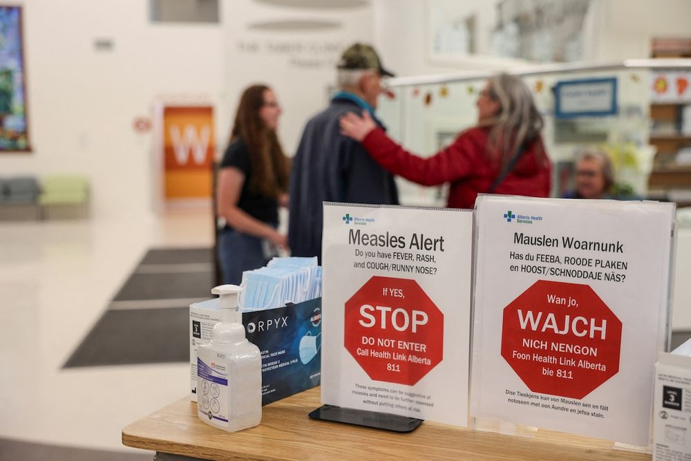 In 1998, Canada earned its elimination status after a successful, years-long campaign to popularize the measles vaccine. But this past year, the country has seen a dramatic rise in the disease with 5,139 cases.