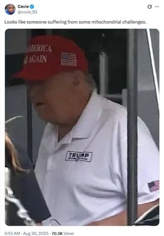 Covie_93 tweets: Looks like someone suffering from some mitochondrial challenges.

Attached is a photo of that baby from Spirited Away crammed into an Edgar suit and polo shirt.